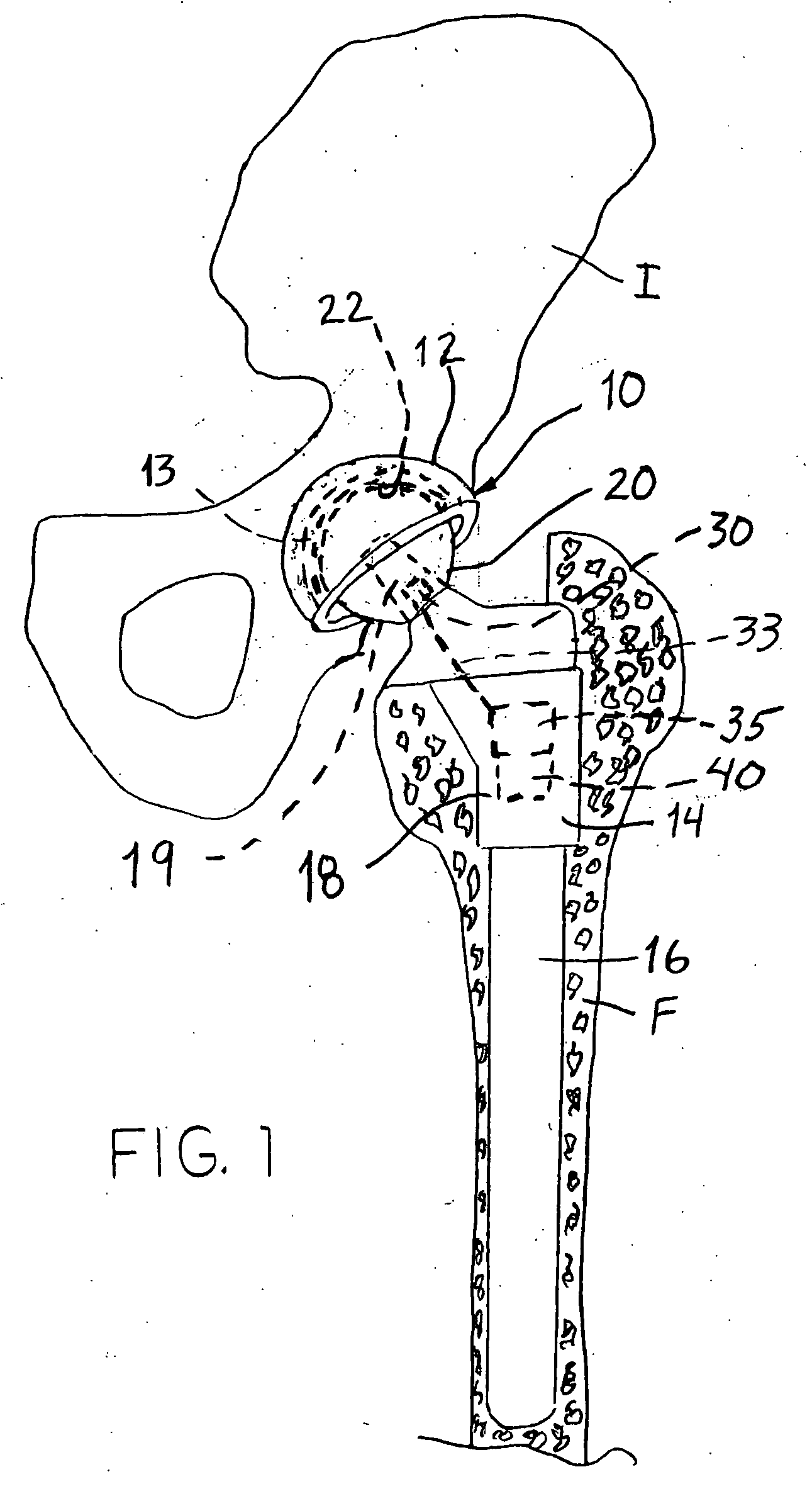 Joint endoprosthesis with ambient condition sensing
