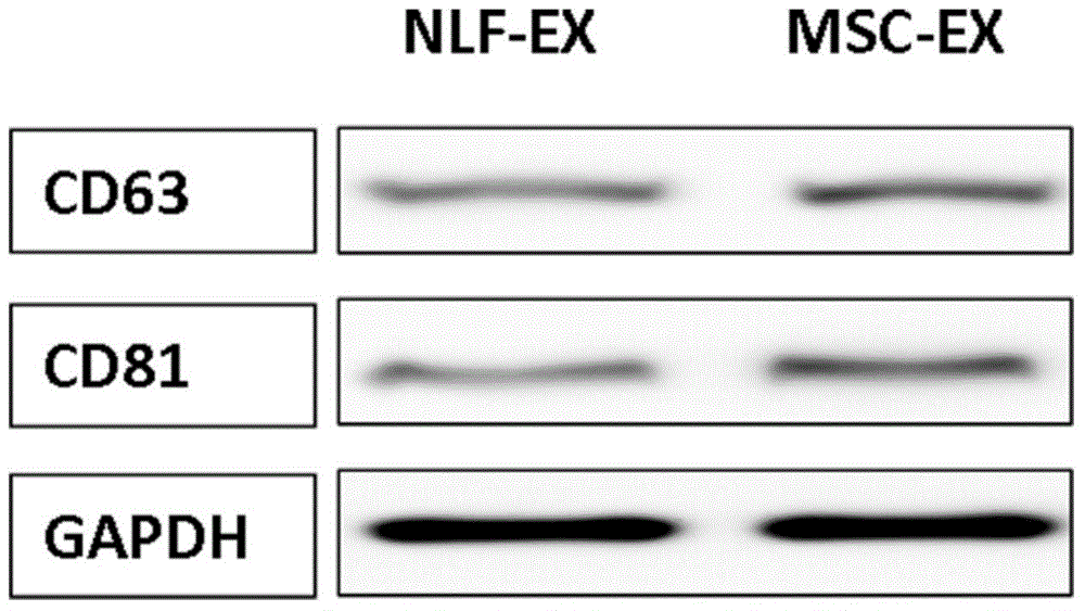 Application of MSC (mesenchymal stem cell) exosomes in preparation of pharmaceutic preparation for treating PF (pulmonary fibrosis)