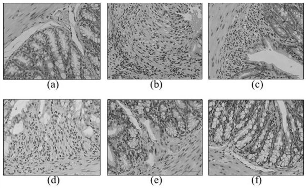 Application of elemonic acid and solid dispersion thereof in preparation of medicine for treating ulcerative colitis