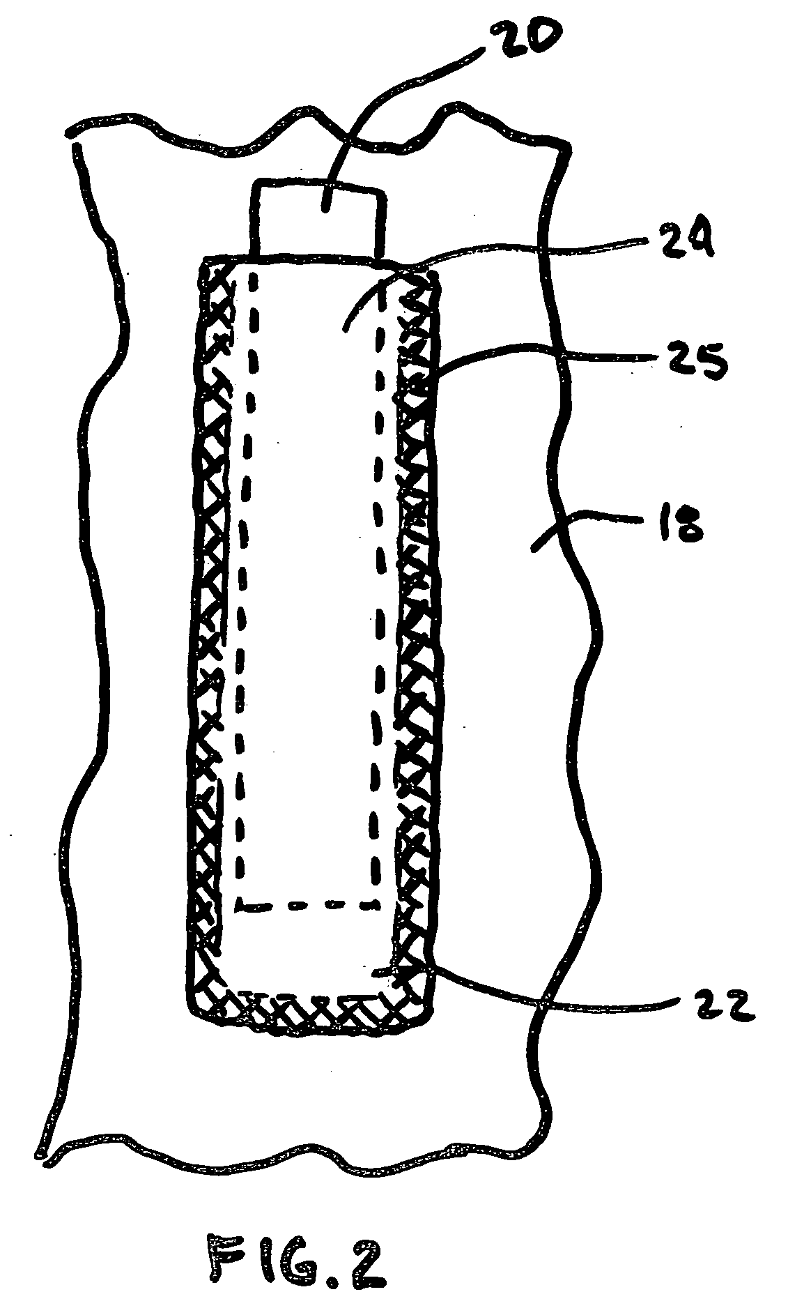 Protective garment containing malleable insert