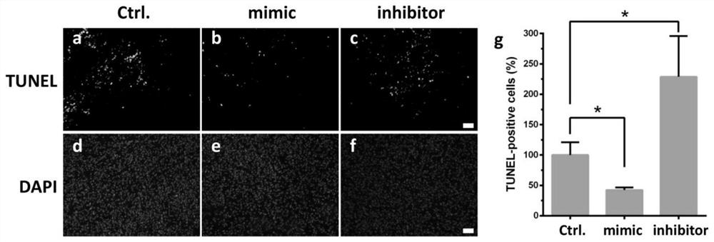 Application of micromolecule RNA hsa-miR-451a in preparation of medicine for treating cerebral arterial thrombosis