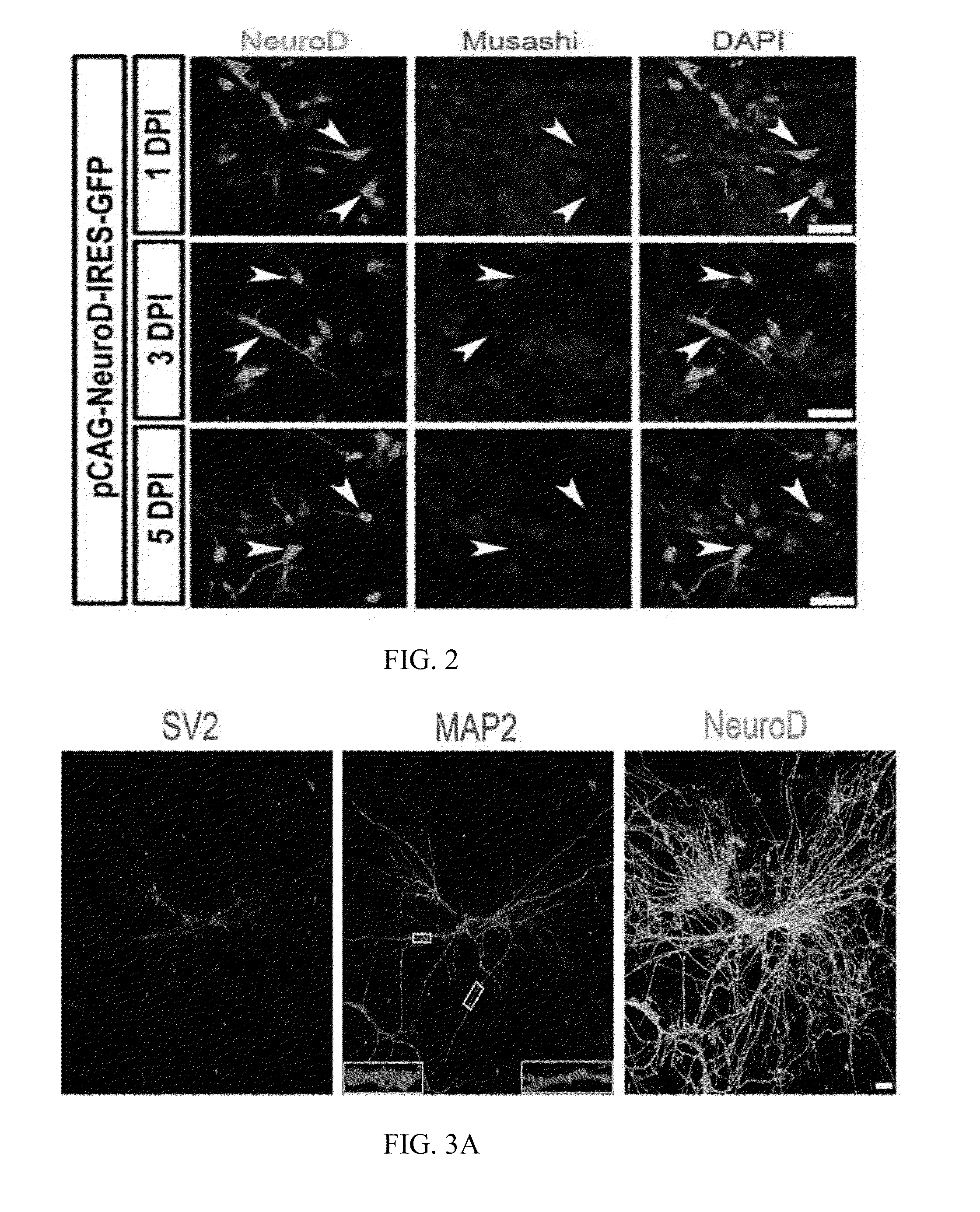 Methods and compositions for treatment of disease or injury of the nervous system