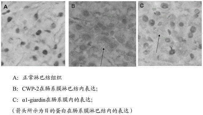 Bivalent DNA vaccine and its enteric-coated preparation for preventing giardiasis