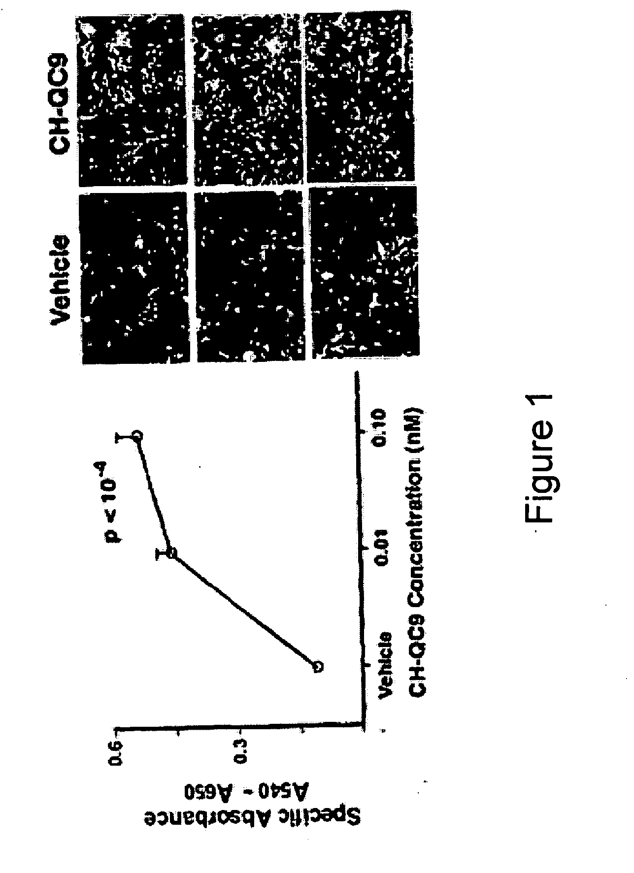 CHEC-7 a novel sPLA2 inhibitor and methods of use for treating neurological and inflammatory disorders