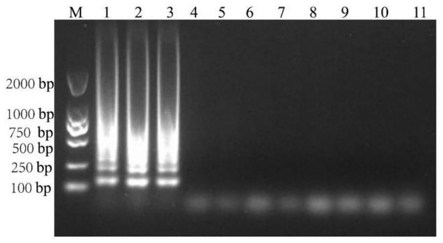 Primer group, detection method and kit for quickly detecting salmonella typhimurium by utilizing LAMP technology