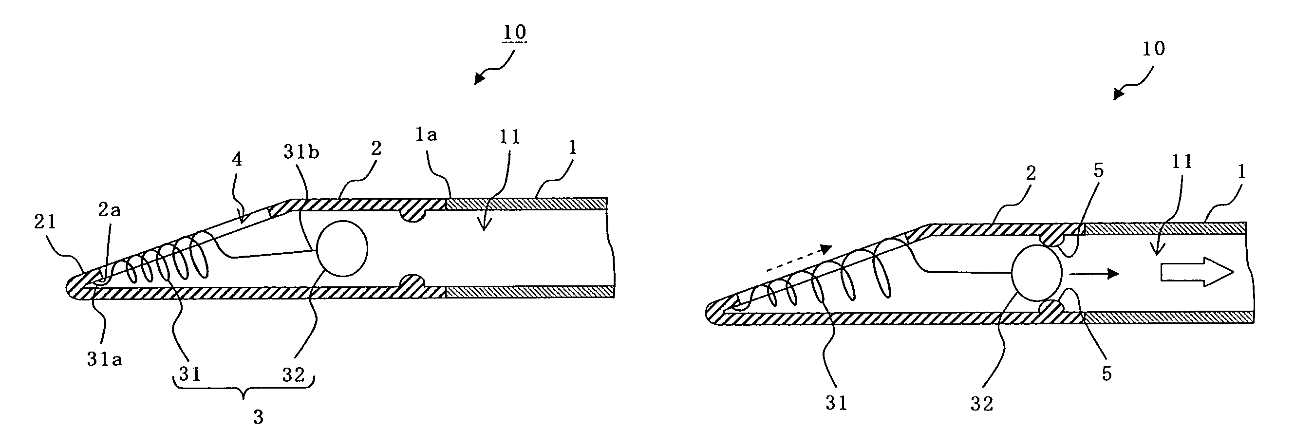 Suction catheter and suction-catheter system