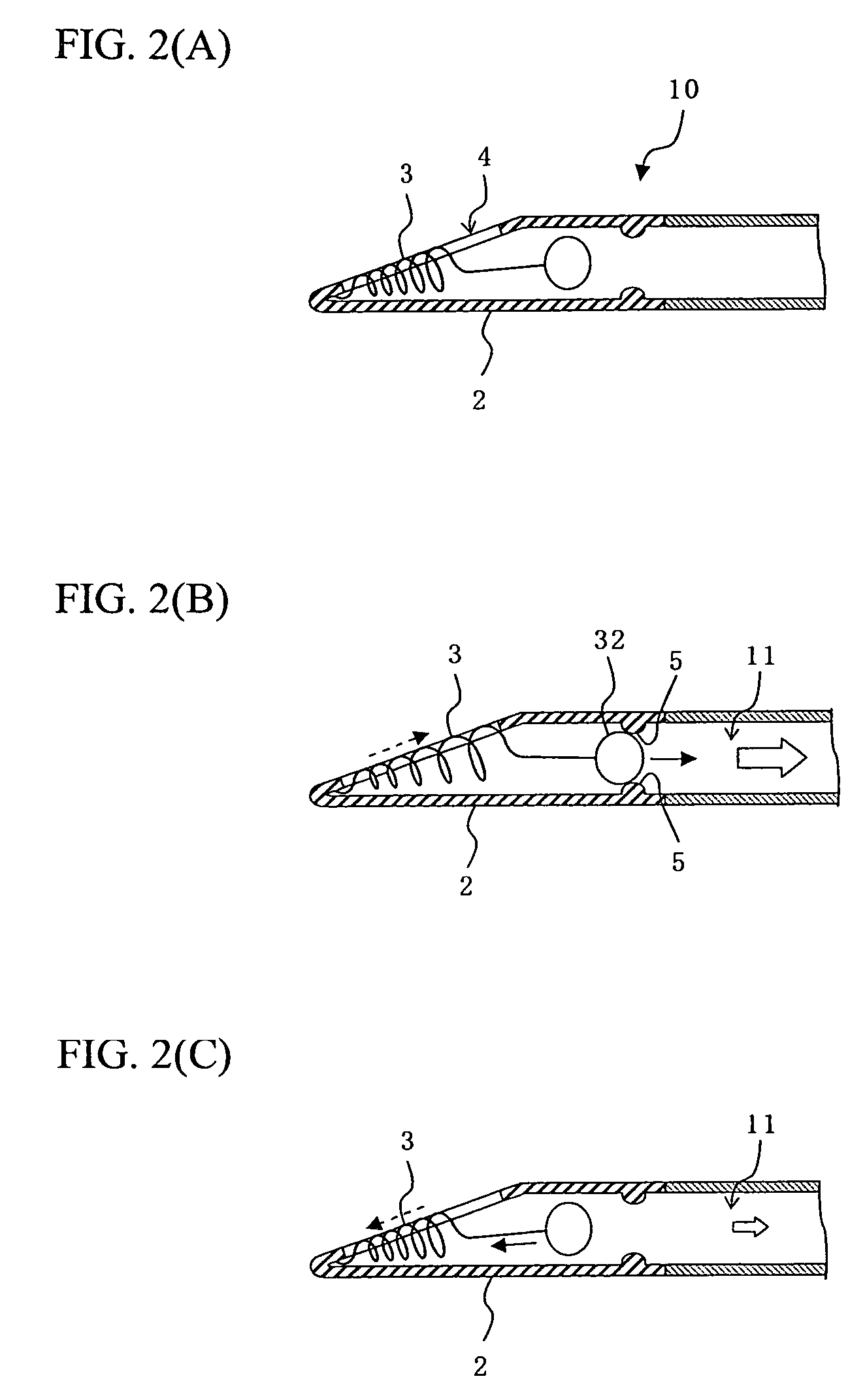 Suction catheter and suction-catheter system