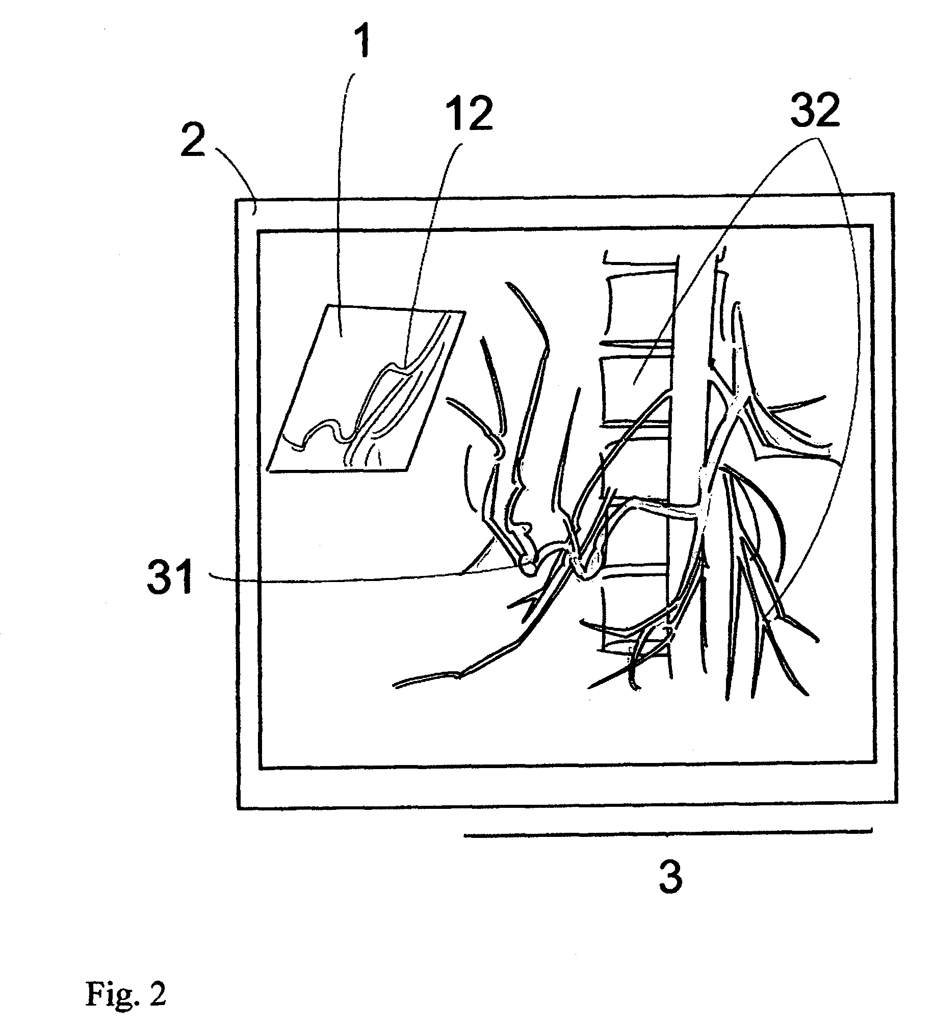 Virtual penetrating mirror device for visualizing virtual objects in angiographic applications