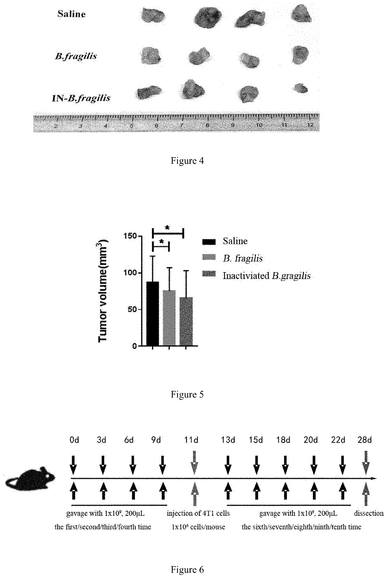 Application of b. fragilis or akkermansia muciniphila in preparation of drug for preventing or treating tumor