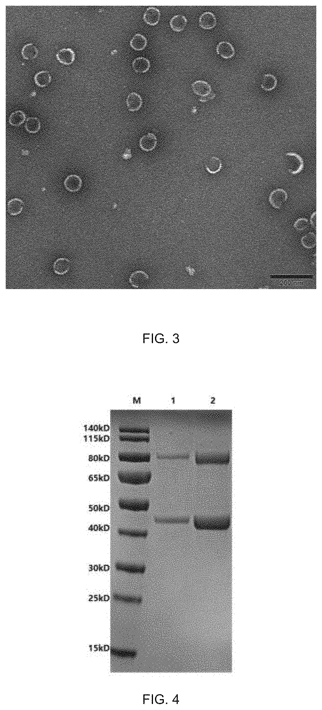 Bovine rotavirus fusion protein and calf diarrhea multivalent vaccine