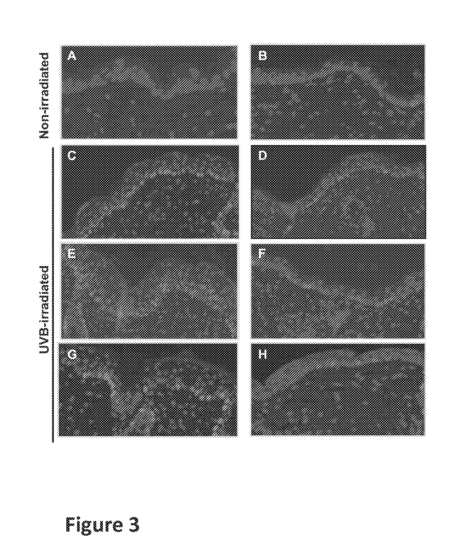 Method for treating cell proliferation disorders