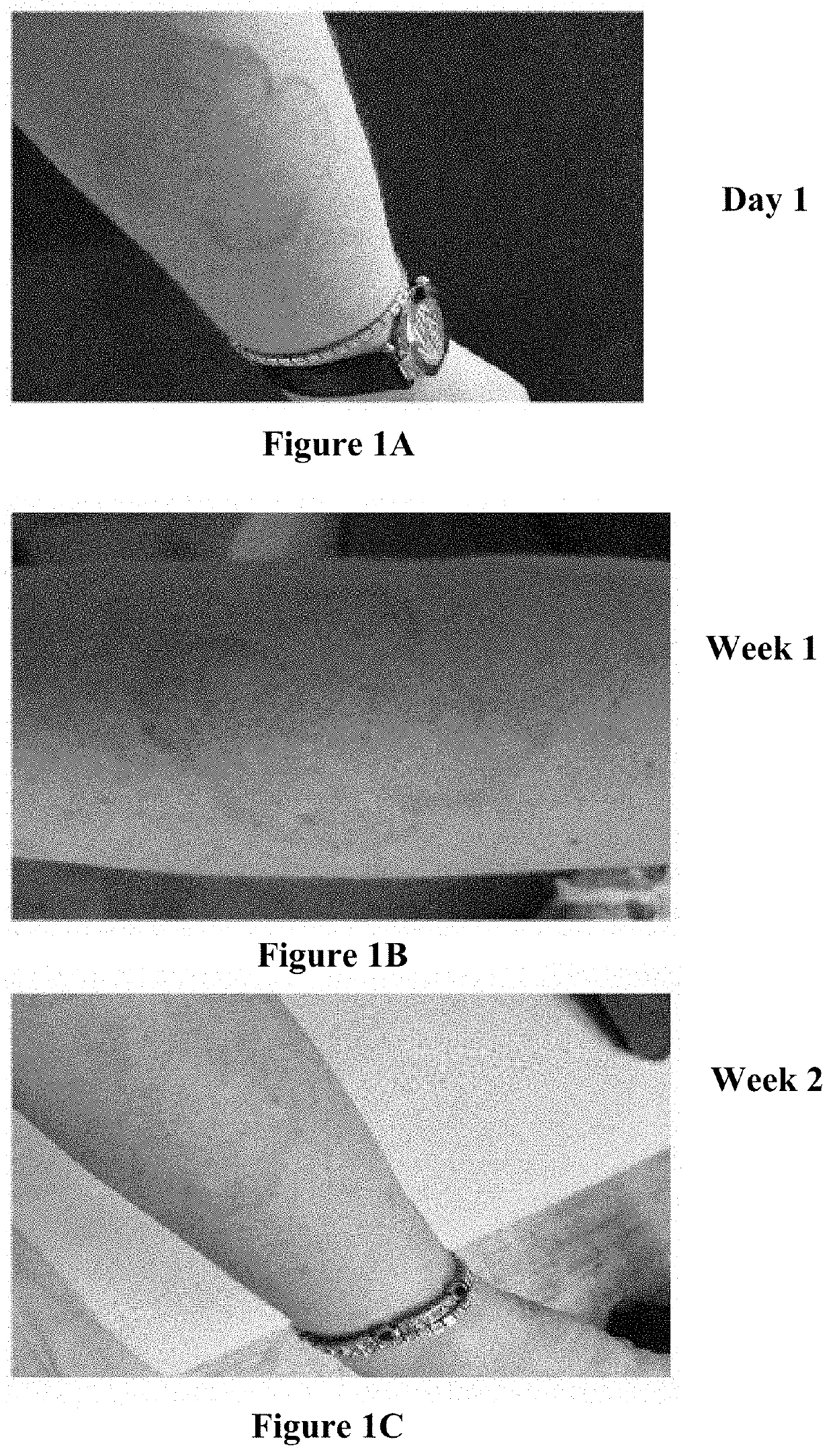 Methods and compositions for the treatment of granuloma annulare or subcutaneous inflammation and non-infection granulomatous diseases