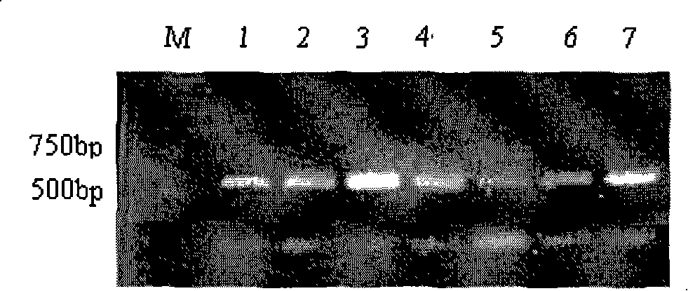 Improved gene construction method and property testing of fast-acting insulin precursor