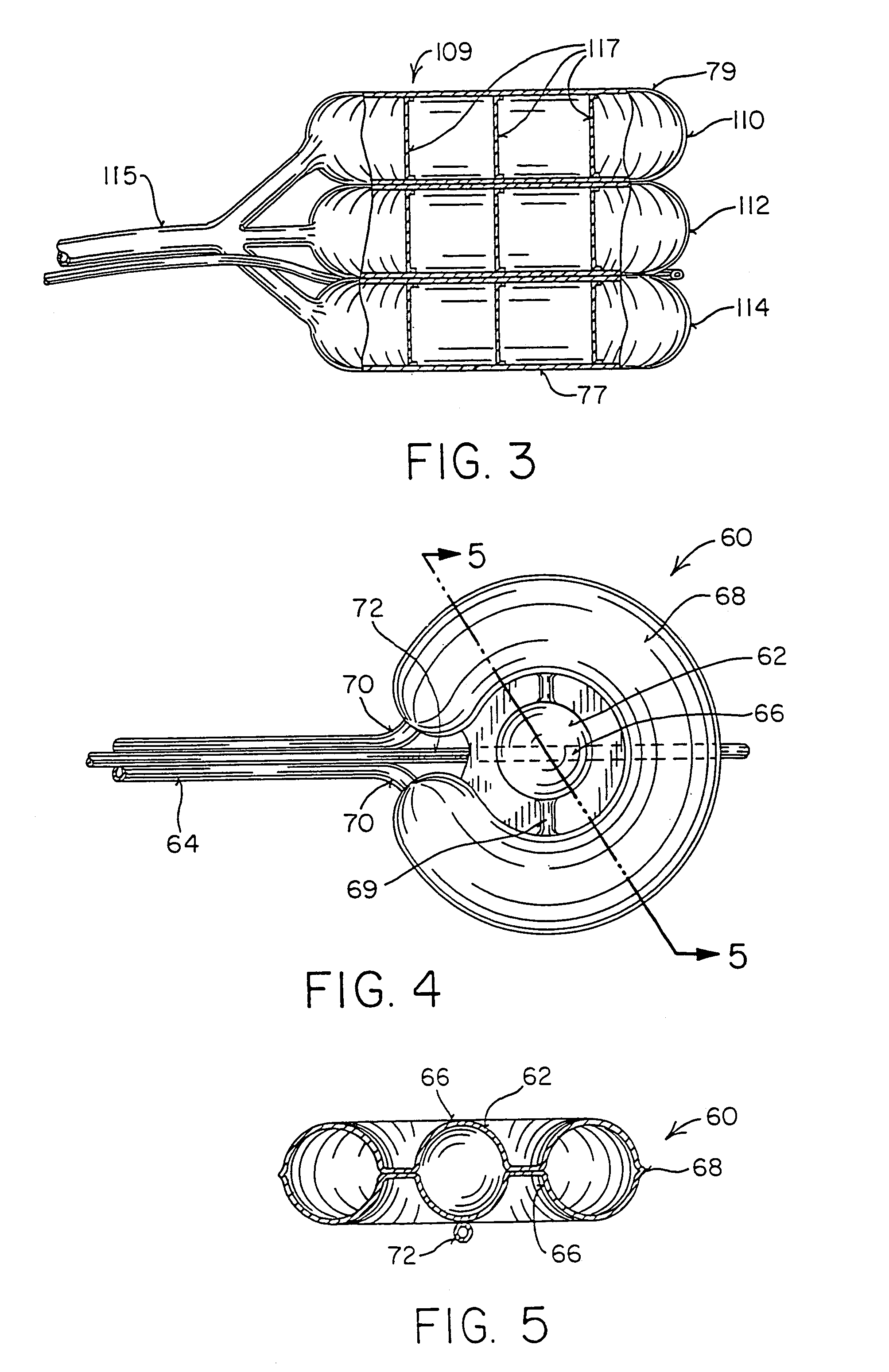 Inflatable device for use in surgical protocol relating to fixation of bone