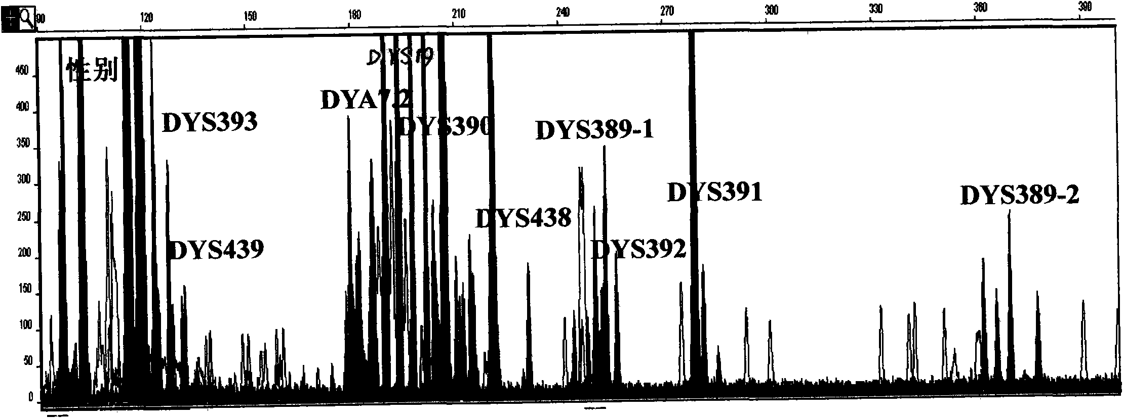 Y-STR locus fluorescent label multiplex amplification system and application thereof