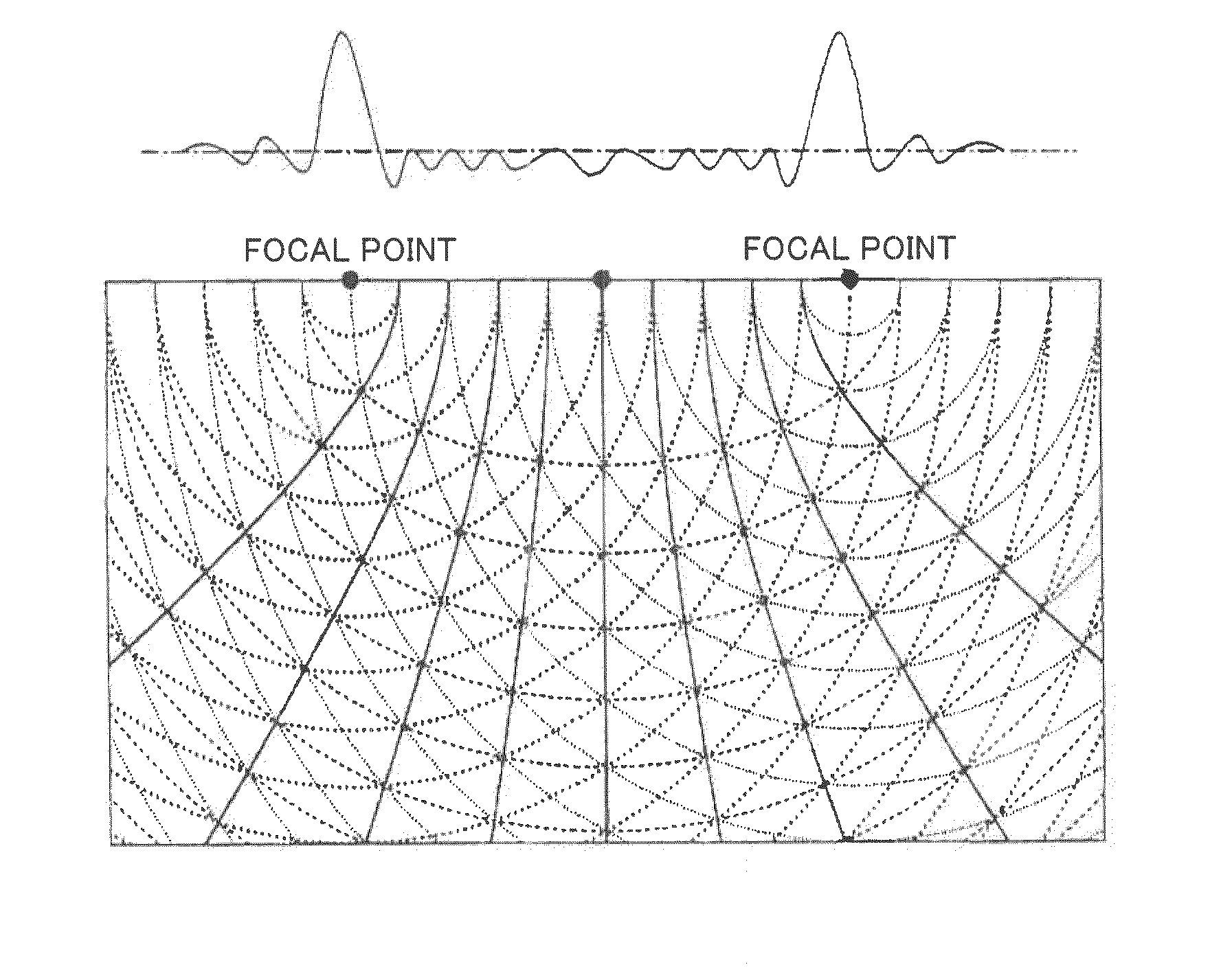 Ultrasonographic diagnostic system and ultrasonic diagnostic device