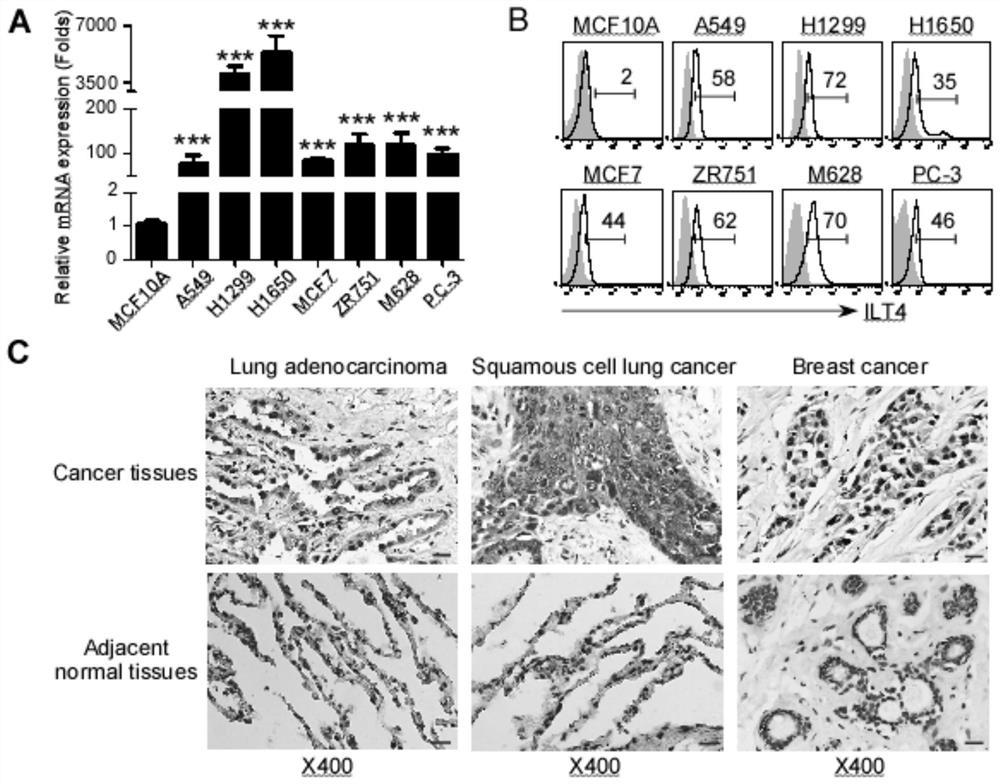 Application of ilt4 in tumor diagnosis and treatment