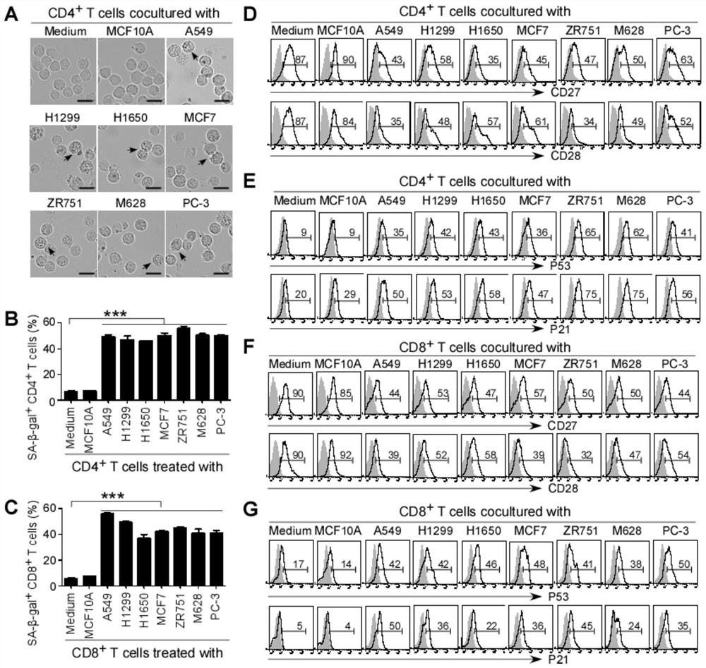 Application of ilt4 in tumor diagnosis and treatment