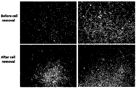 A kind of preparation method and application of periodontal tissue-specific extracellular matrix ECM