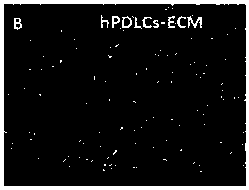 A kind of preparation method and application of periodontal tissue-specific extracellular matrix ECM