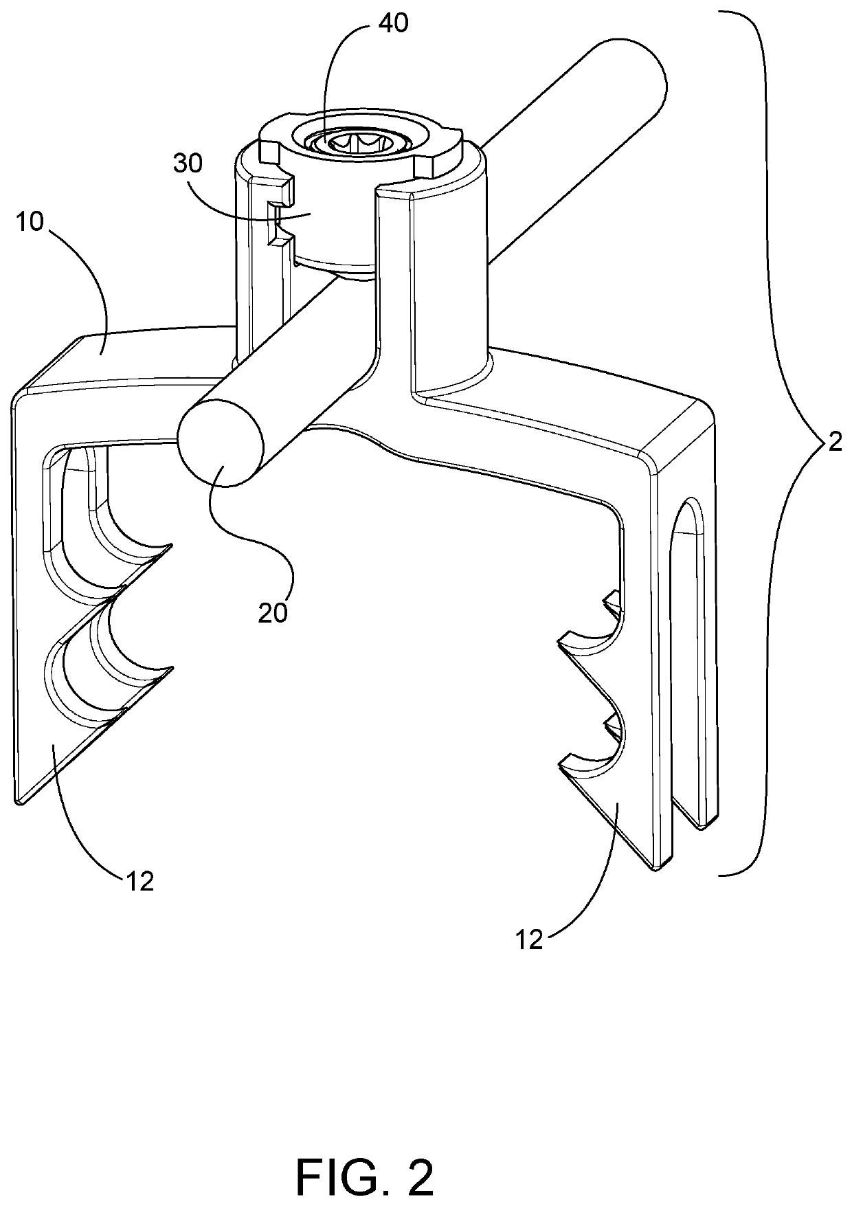 Growth and motion sparing tethers and bone anchor implants for the treatment and correction of spine deformities