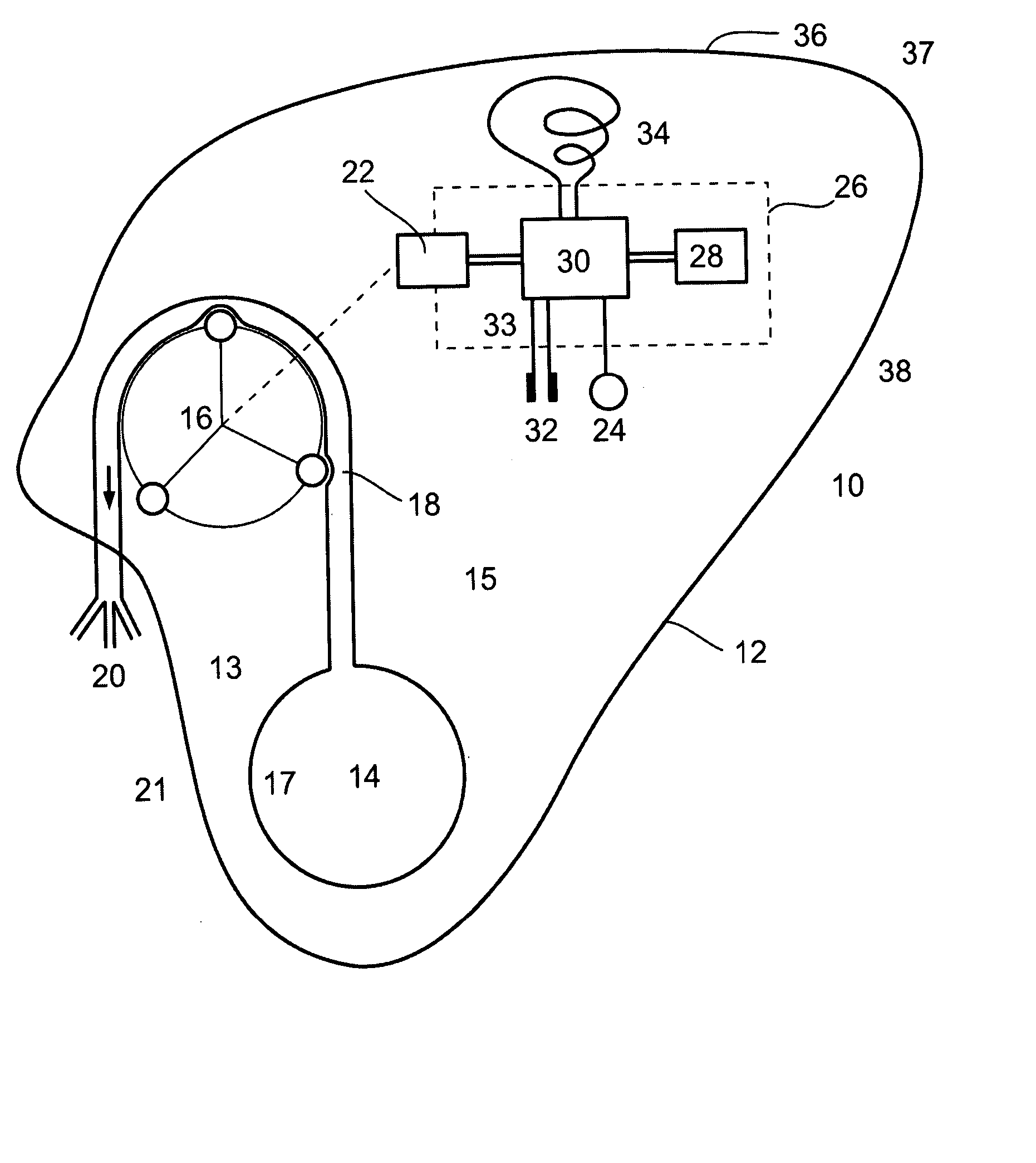 Device and Method for Treating Weight Disorders