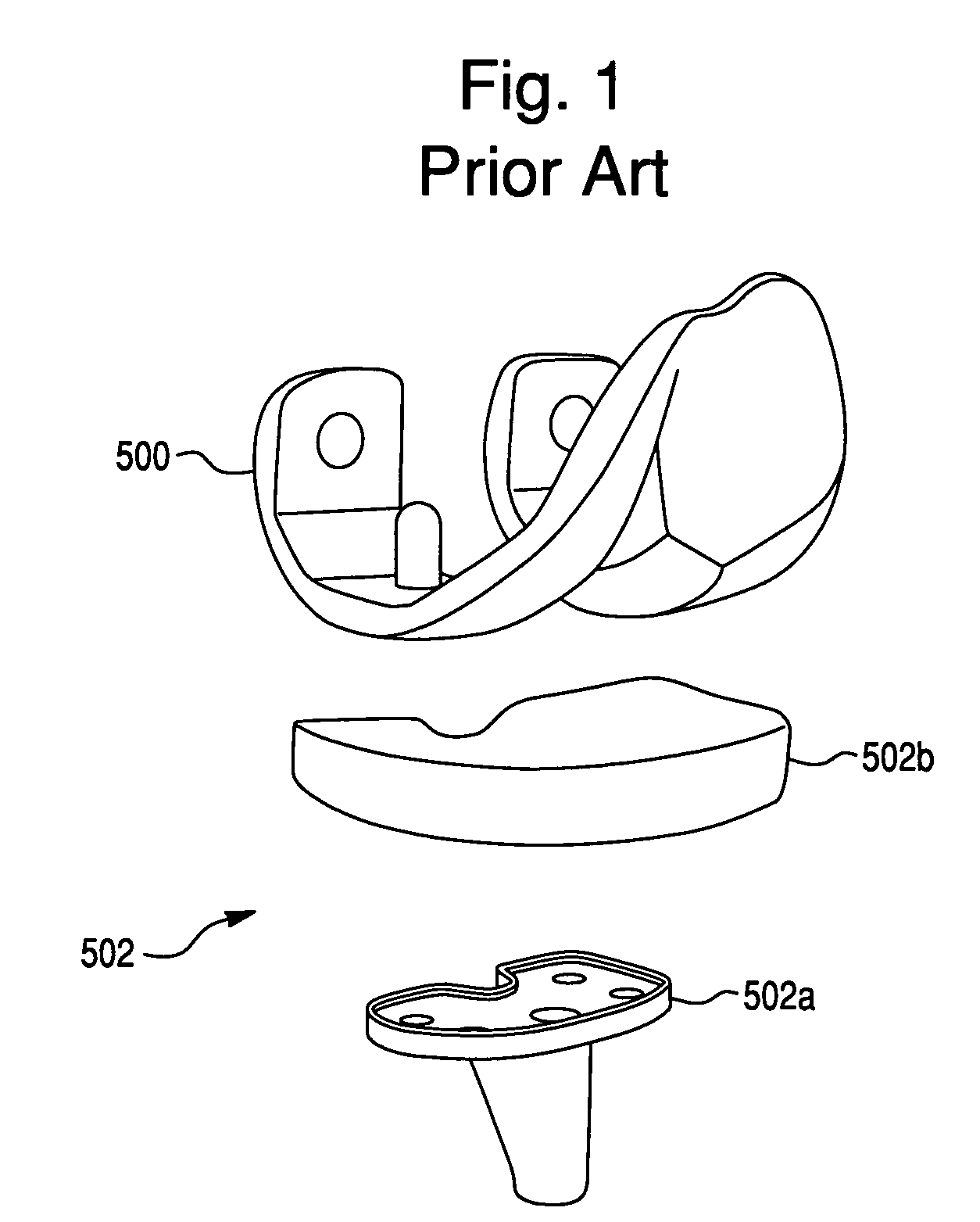 Multi-compartmental prosthetic device with patellar component transition
