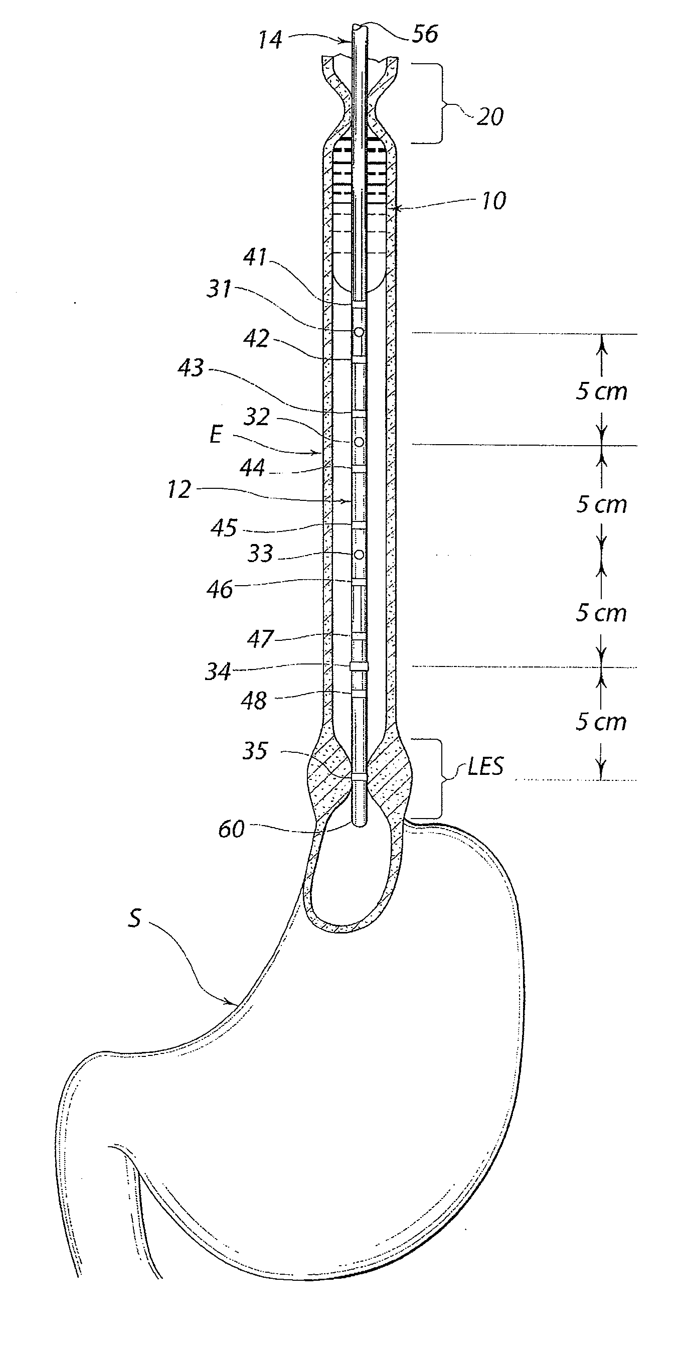 Method of esophageal function testing with a standardized thixotropic swallow challenge medium