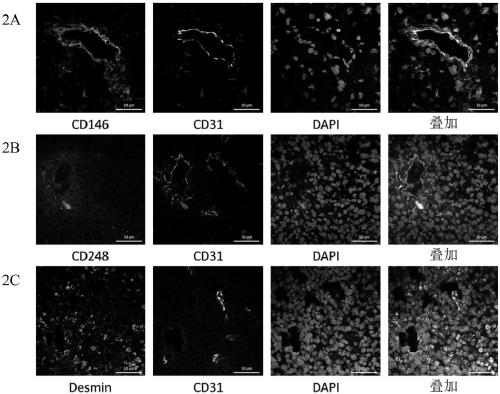 Application of cd146 monoclonal antibody in the detection and isolation of glioma pericytes