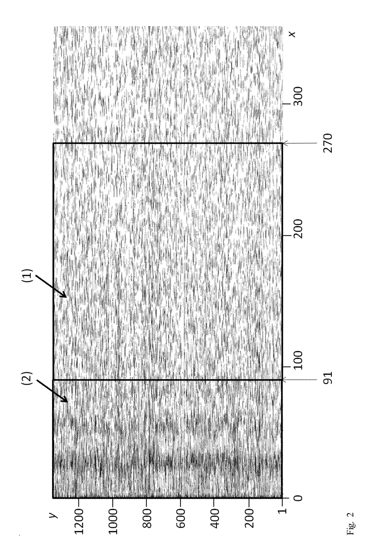 Prediction of bleeding patterns in women after insertion of an intrauterine active-ingredient-releasing system