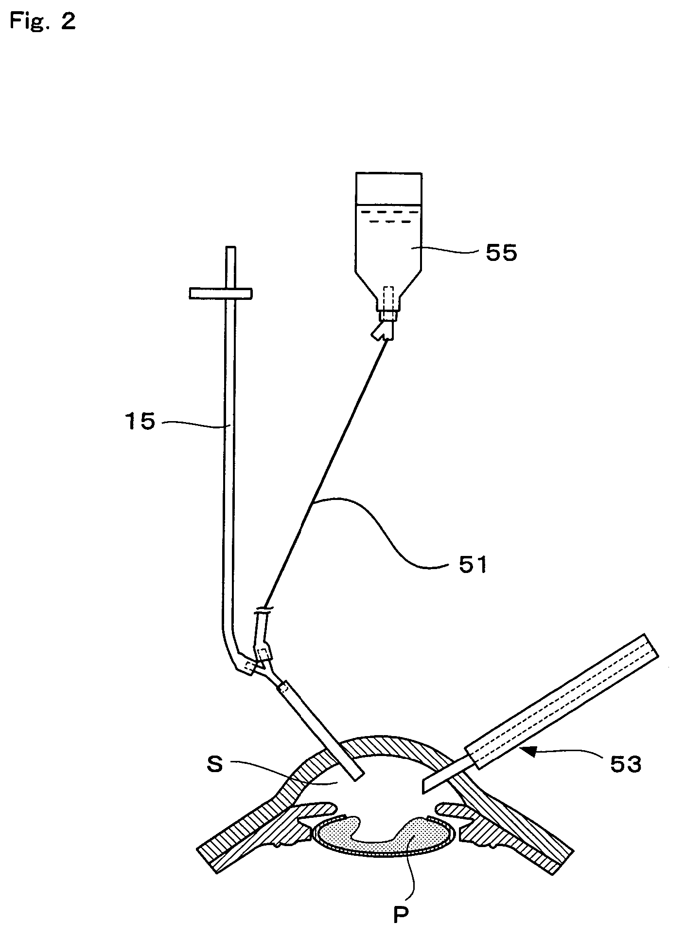 Decompression-compensating instrument for ocular surgery, instrument for ocular surgery provided with the same and method of ocular surgery