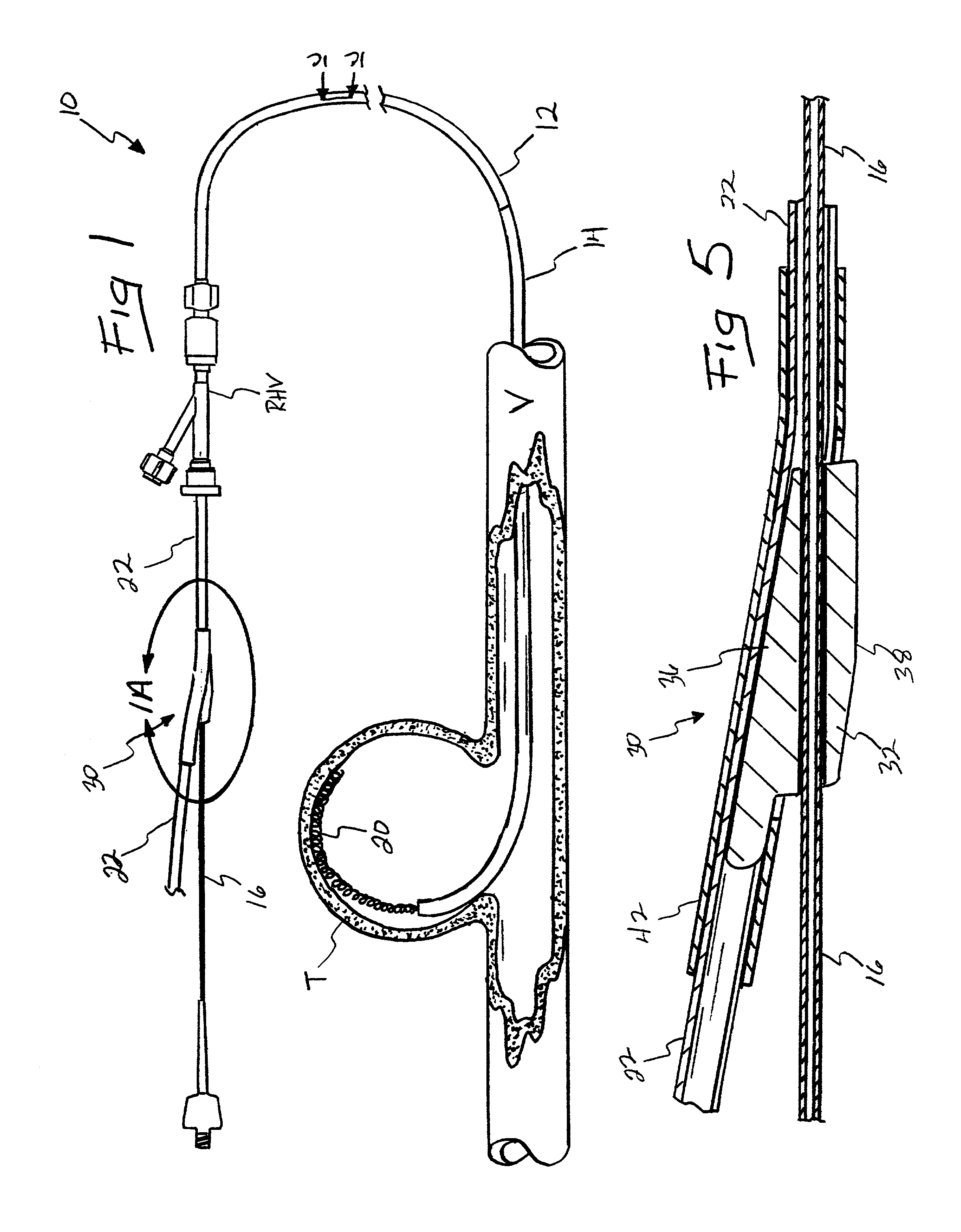 Endovascular catheter resheathing apparatus and related methods