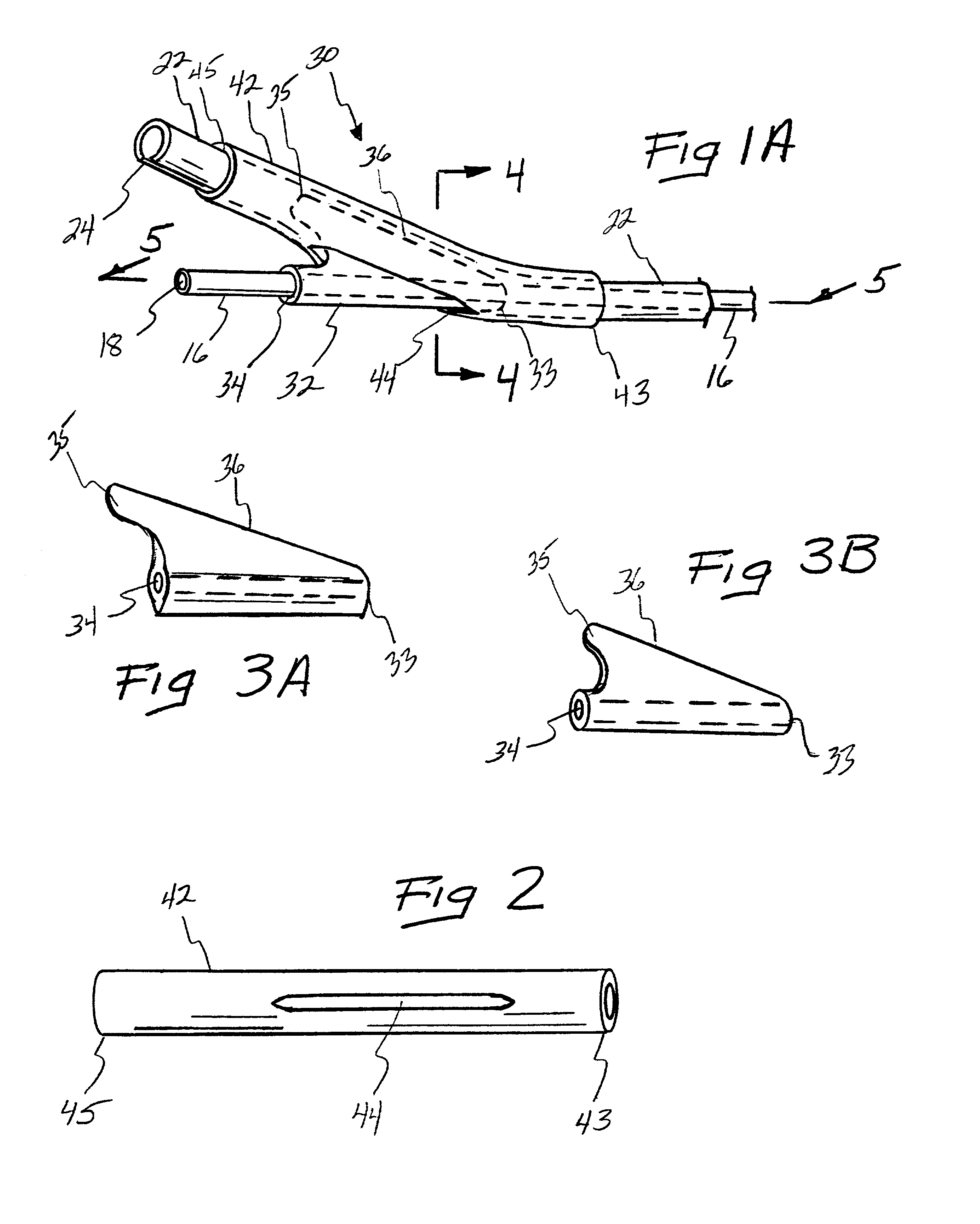 Endovascular catheter resheathing apparatus and related methods