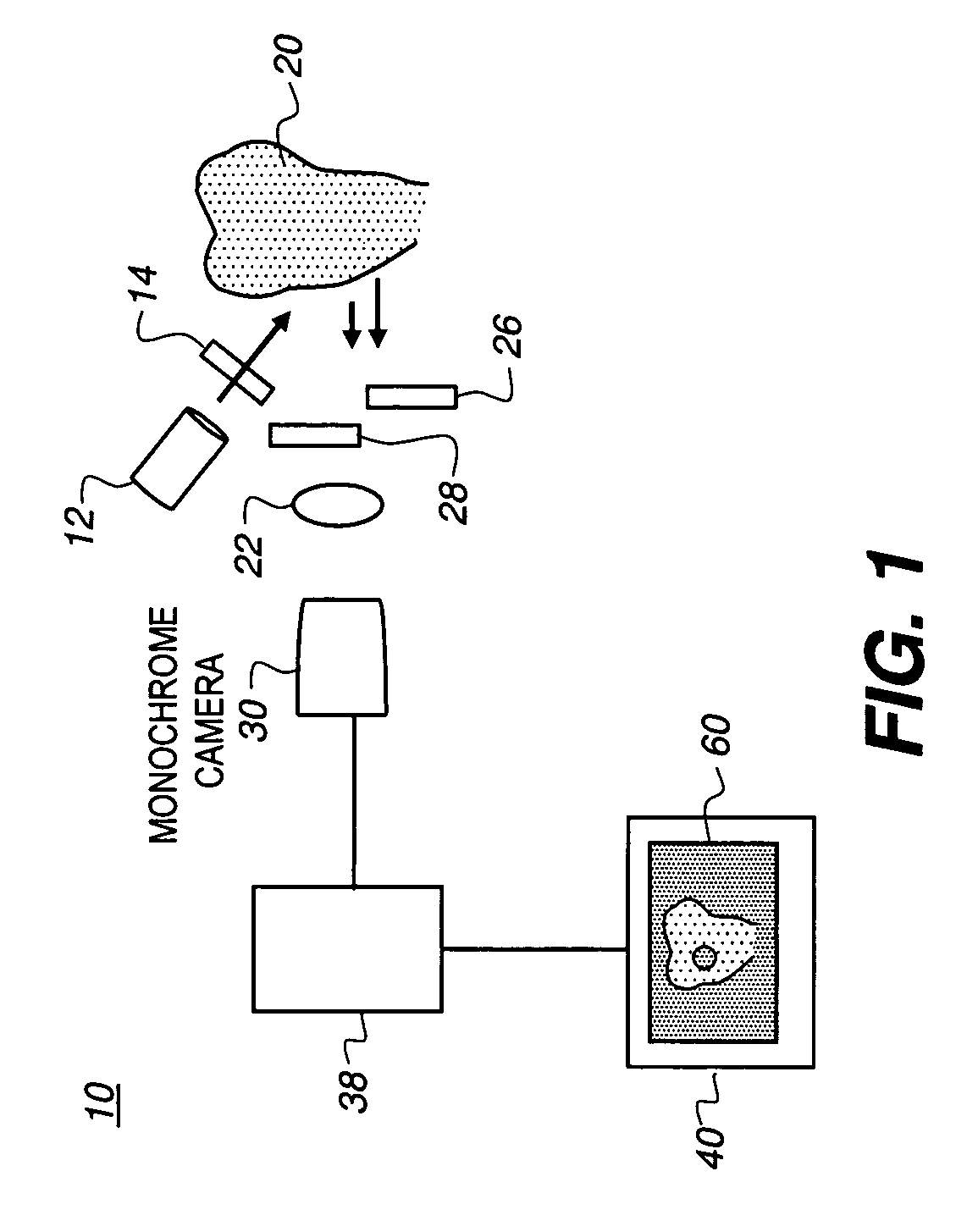 Method and apparatus for detection of caries