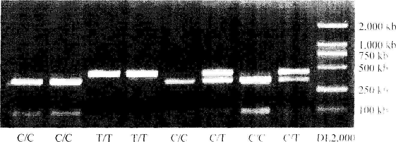 Method for detecting genotype of gene CYP1A2 associated with medicament metabolism ability and liver cancer susceptibility