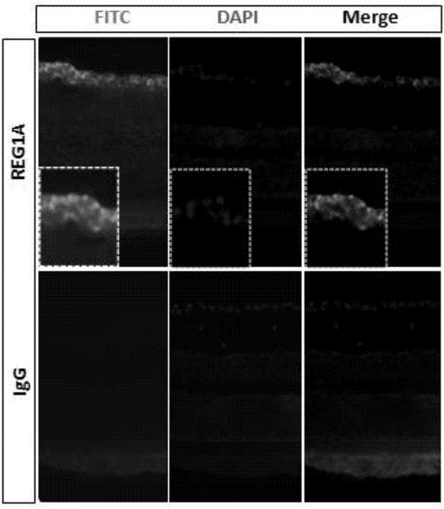 Application of REG1A protein in preparation of drugs for treating and/or preventing retinal cell apoptosis