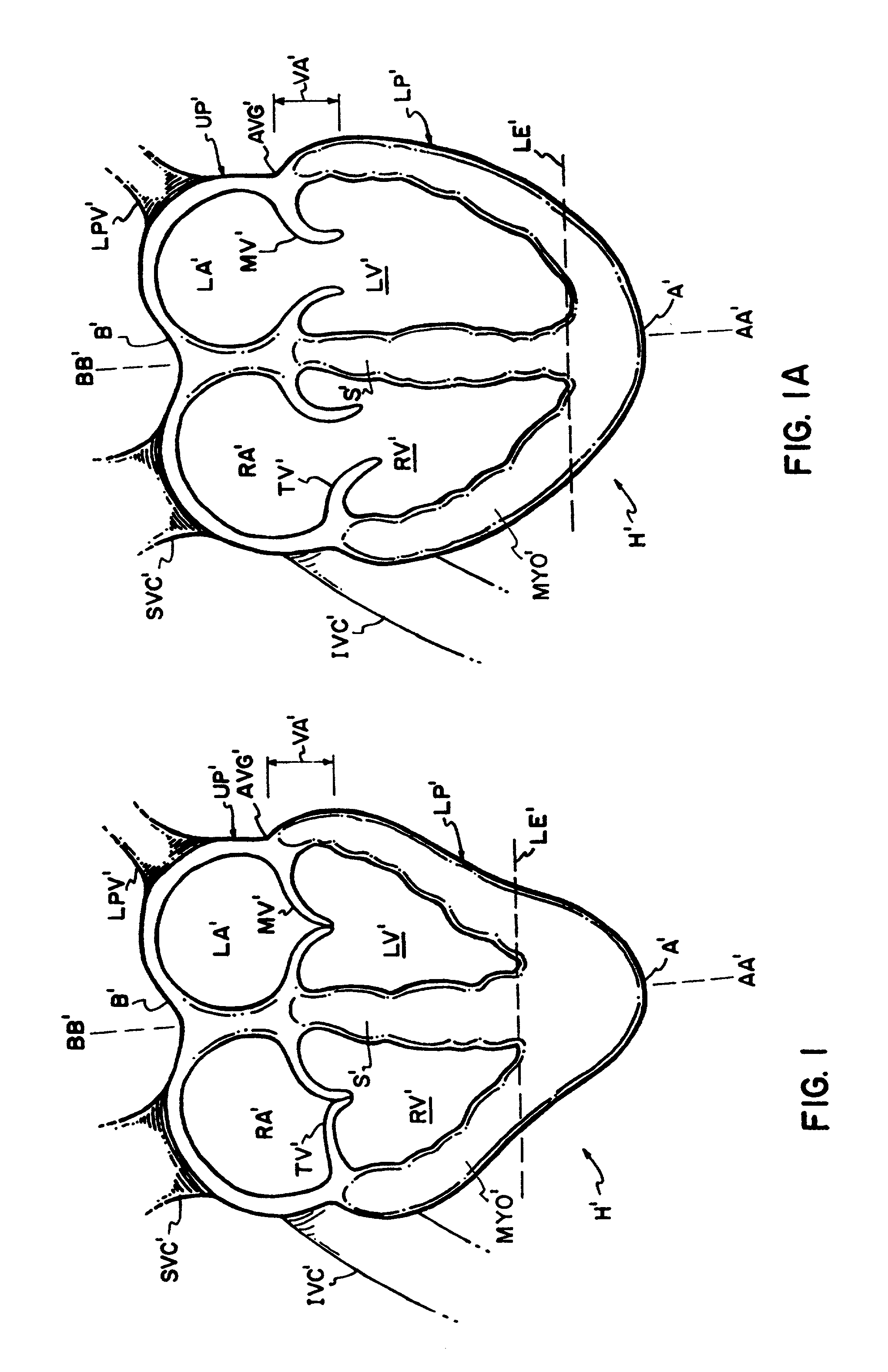Device for heart measurement