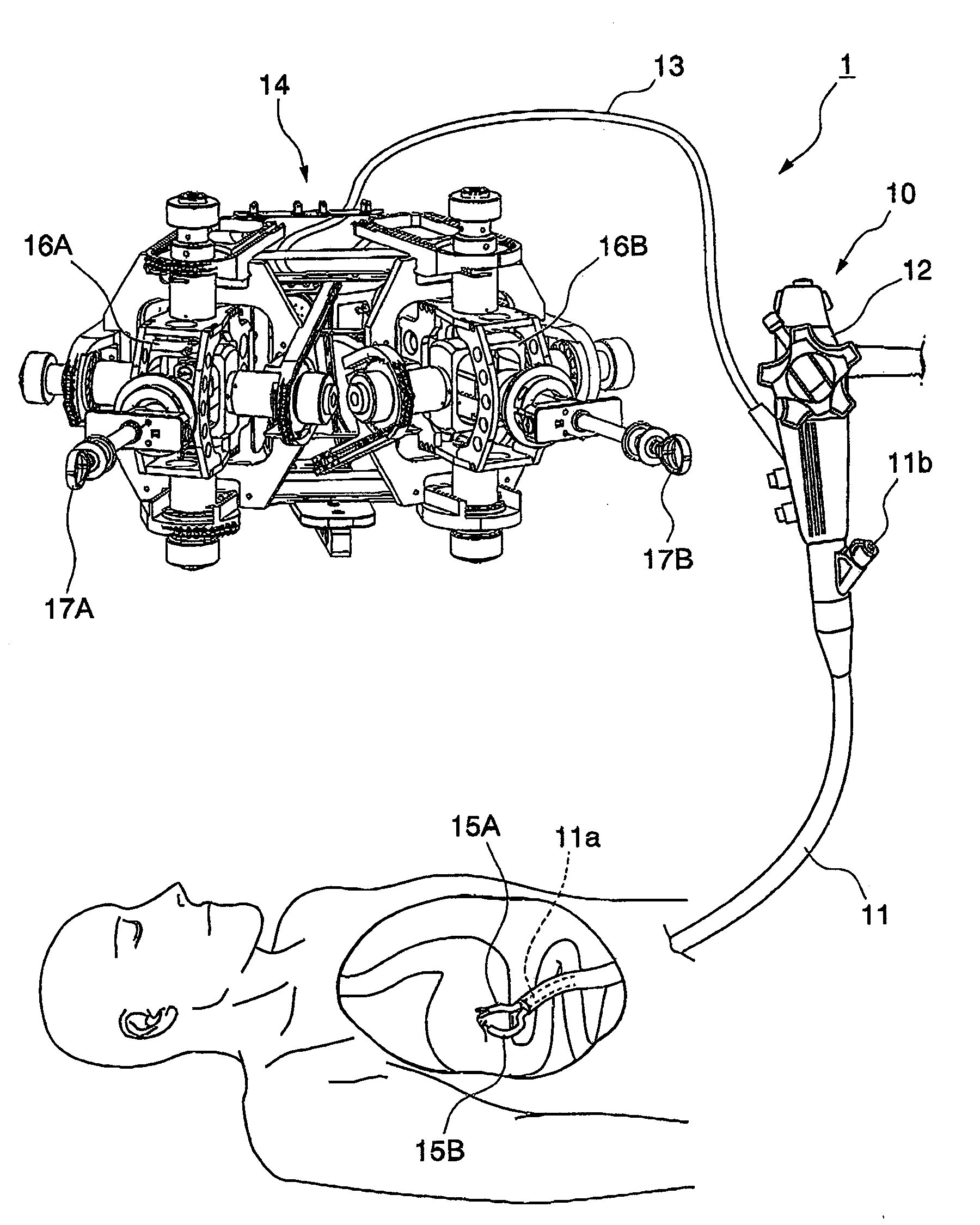 Endoscopic surgical procedure and surgical apparatus