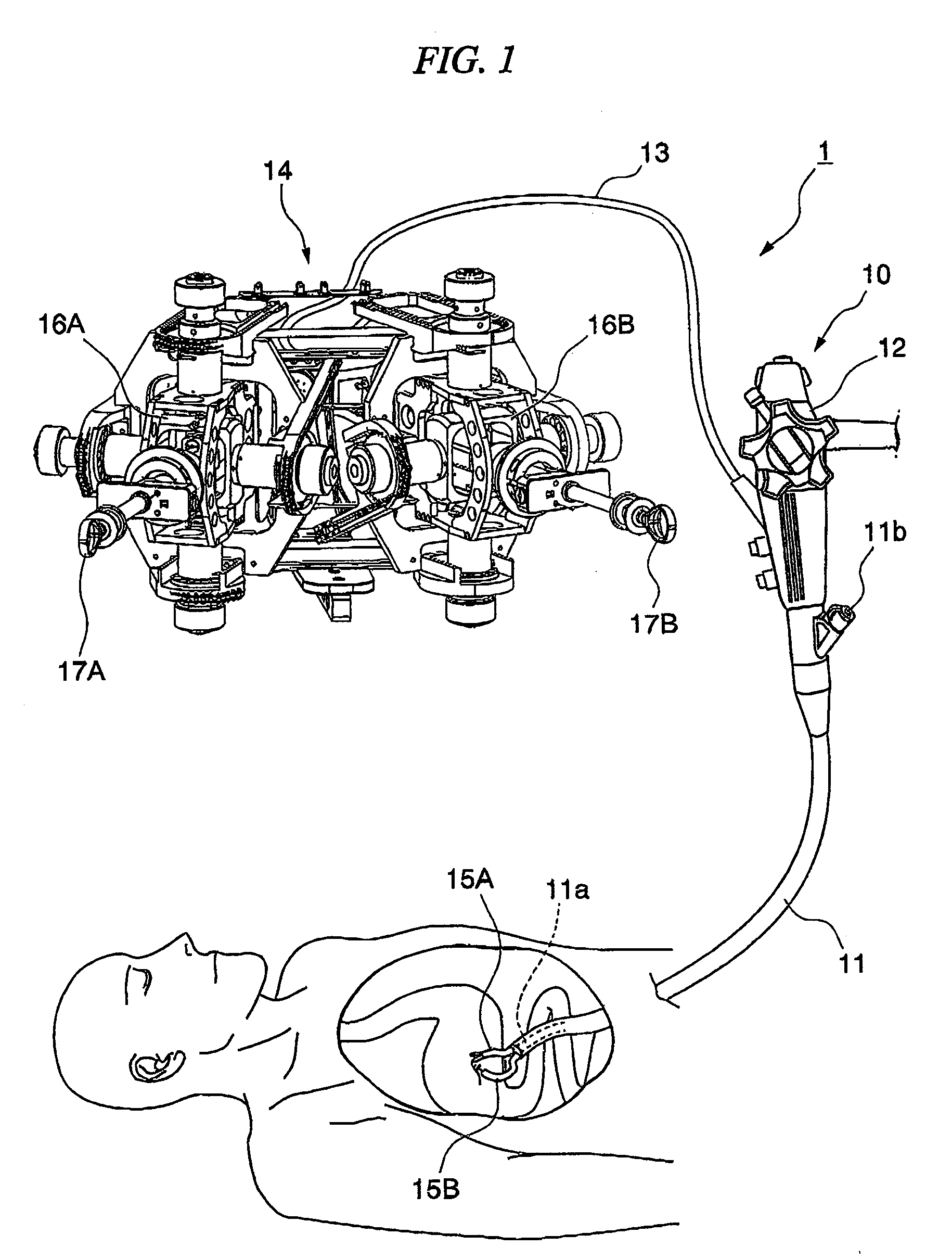 Endoscopic surgical procedure and surgical apparatus
