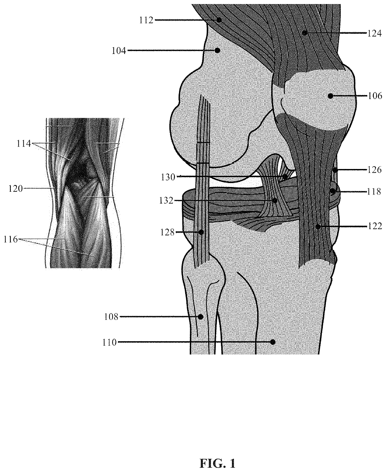 System and method for a wearable knee injury prevention