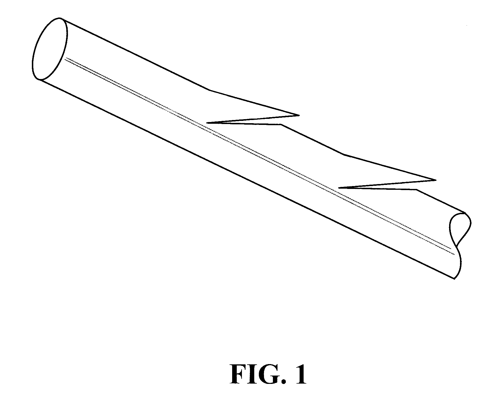 Method of Forming Barbs on a Suture