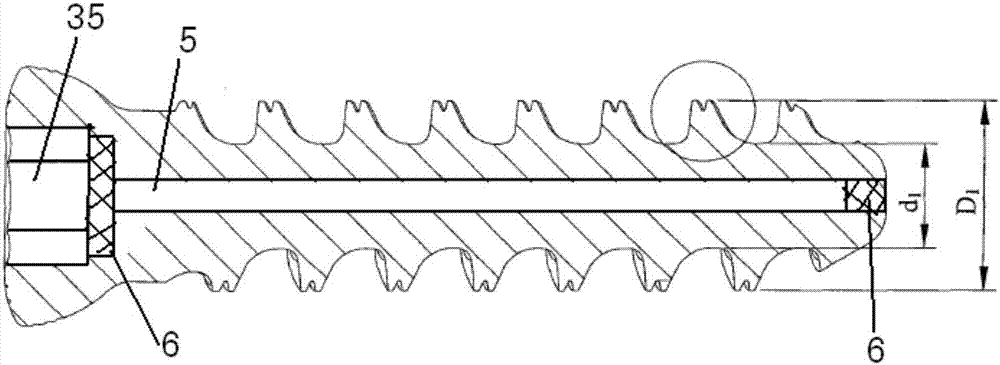 Medical cranium nail structure