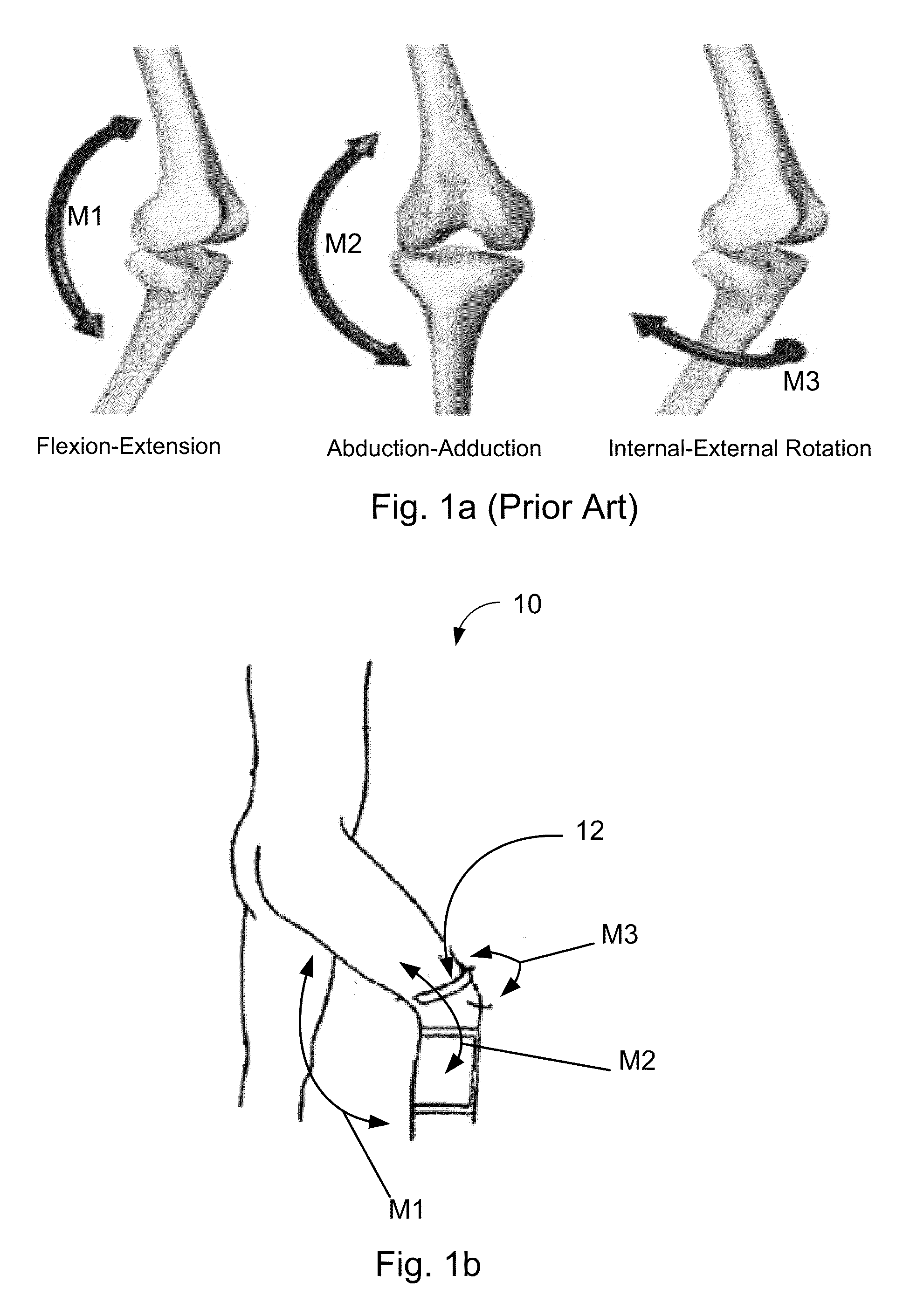 Method and system for human joint treatment plan and personalized surgery planning using 3-d kinematics, fusion imaging and simulation