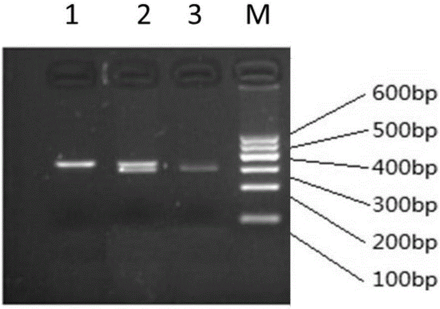 Method for detecting esophagus cancer susceptibility gene PTEN polymorphism with Hae III