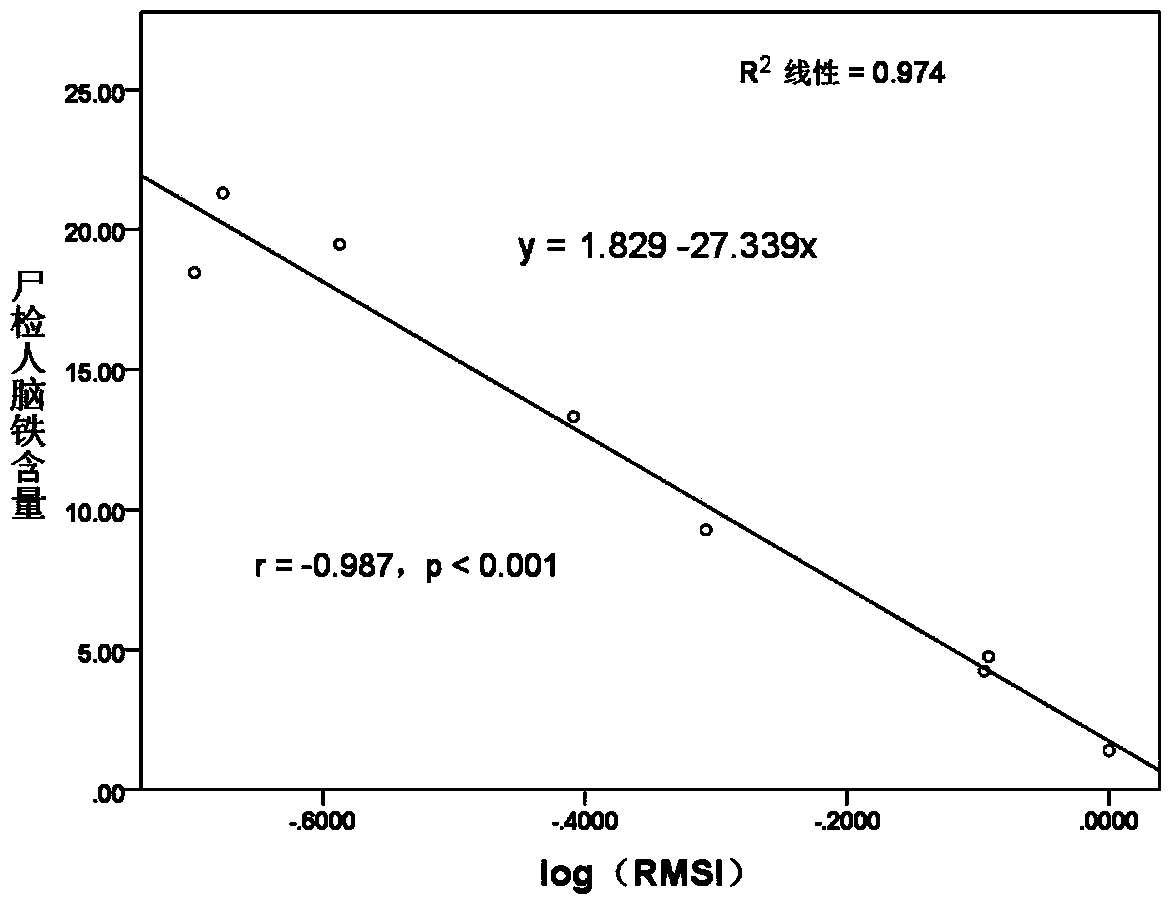 Noninvasive method for determining iron content in brain tissue