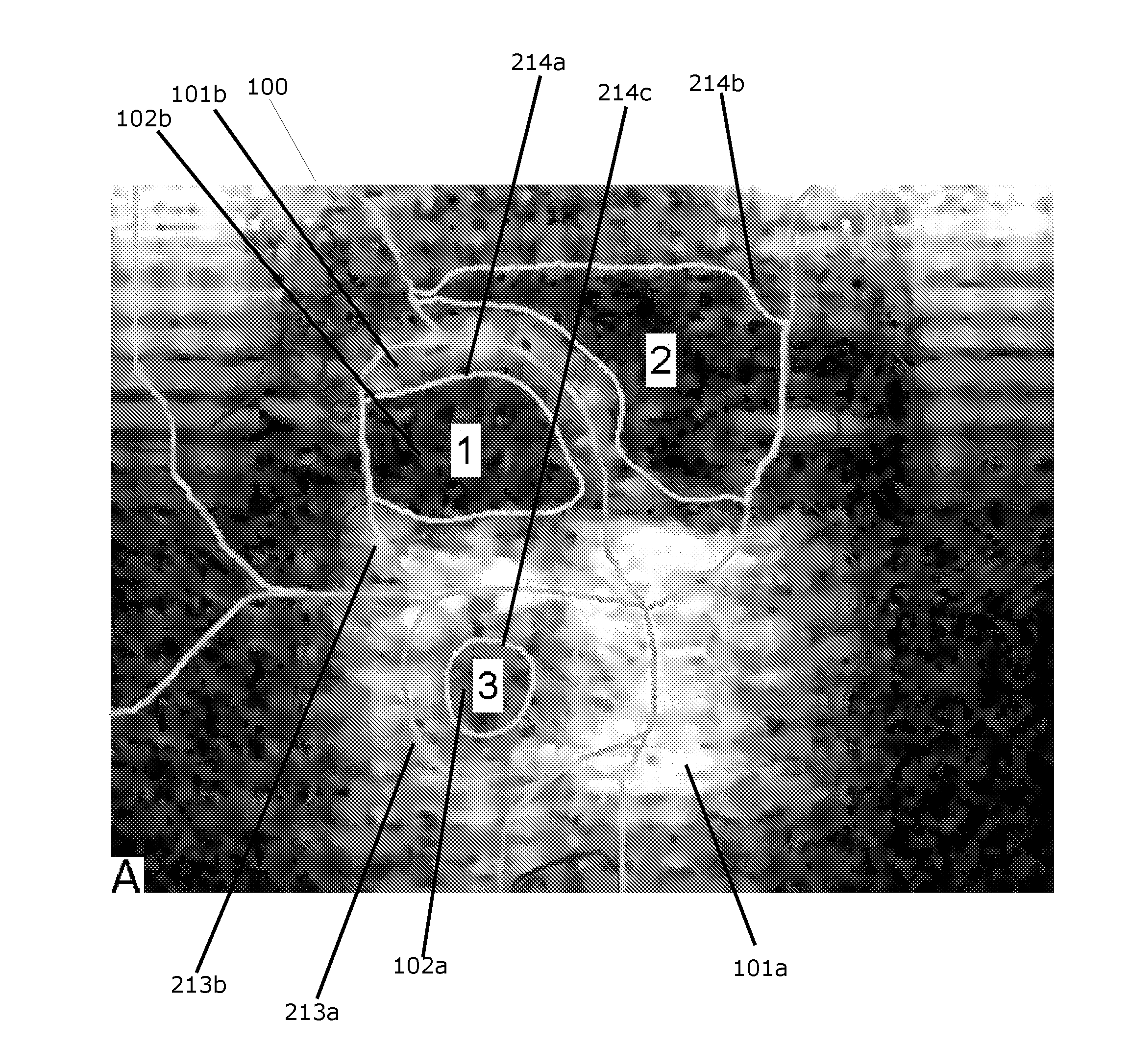 System for detecting blood vessel structures in medical images