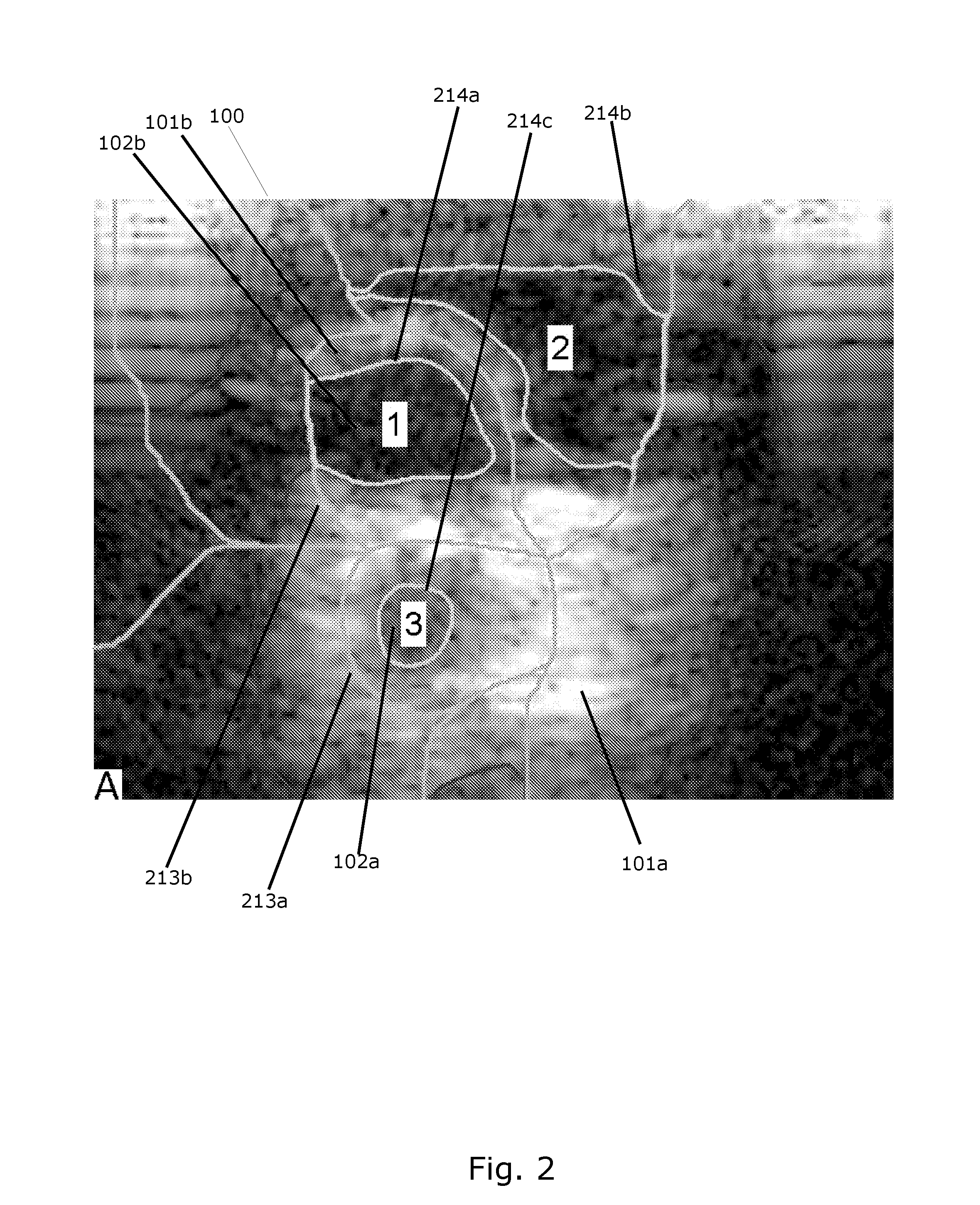 System for detecting blood vessel structures in medical images