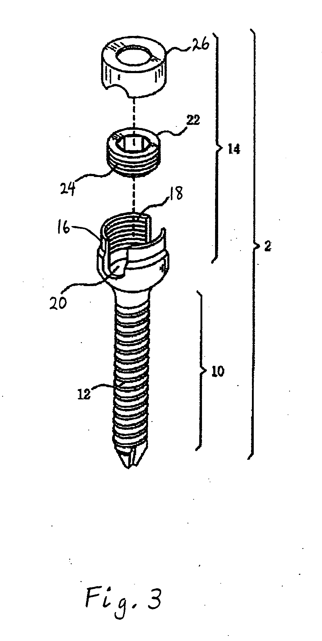 Marking and guidance method and system for flexible fixation of a spine