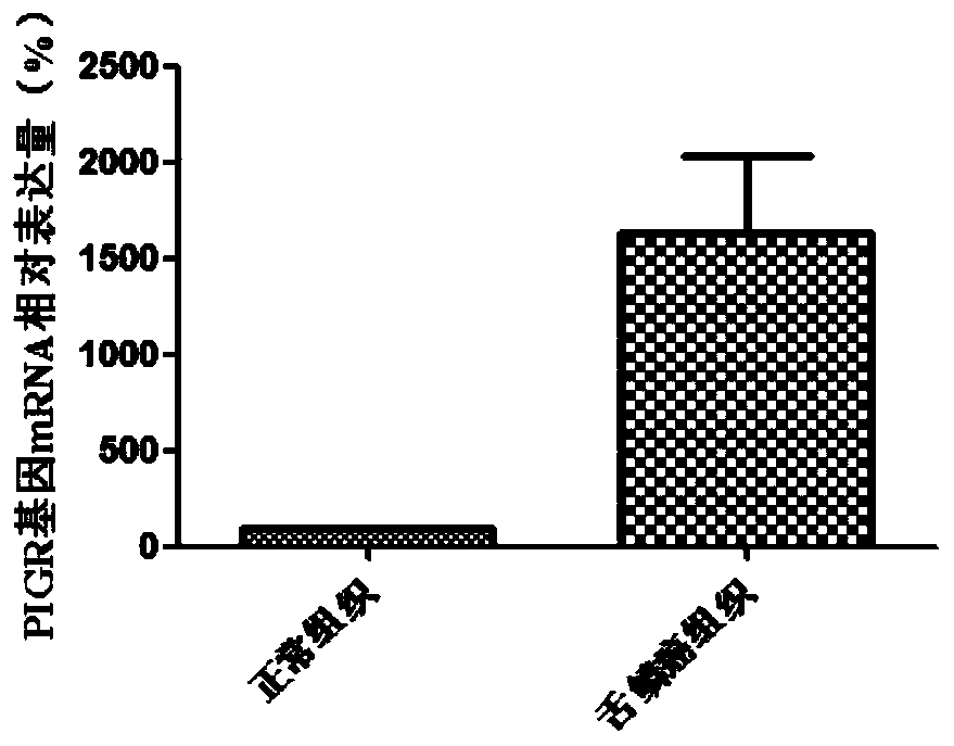 Diagnosis and treatment markers of tongue squamous cell carcinoma