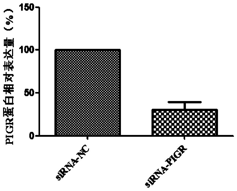 Diagnosis and treatment markers of tongue squamous cell carcinoma